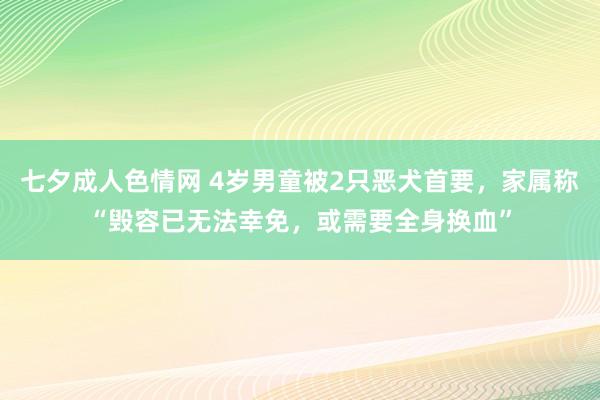 七夕成人色情网 4岁男童被2只恶犬首要，家属称“毁容已无法幸免，或需要全身换血”